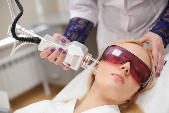 Gesichtslaserverjüngung