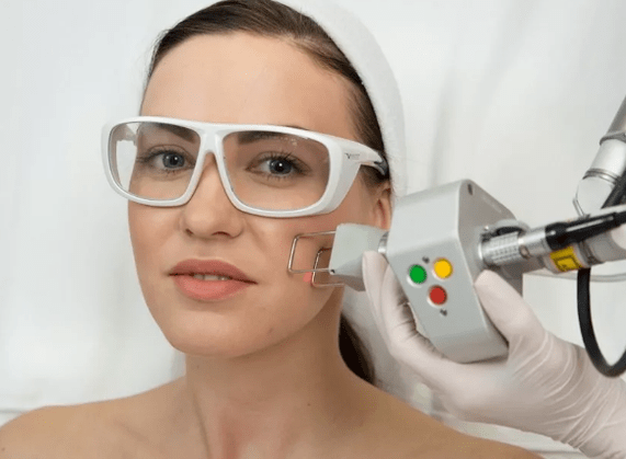 Feldlaserverjüngung