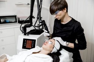 Laserverjüngung