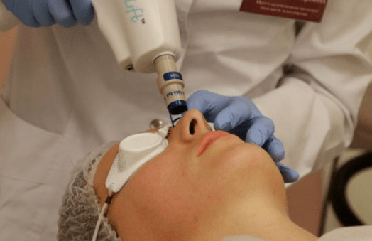 Bemerkenswerte Laserverjüngung
