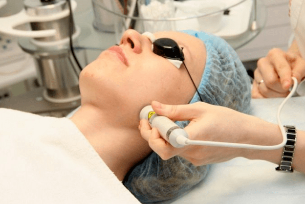 Laserbiorevitalisierung