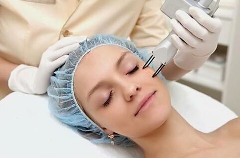 Feldlaser